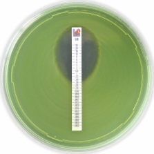 MTS™ (MIC Test Strip)