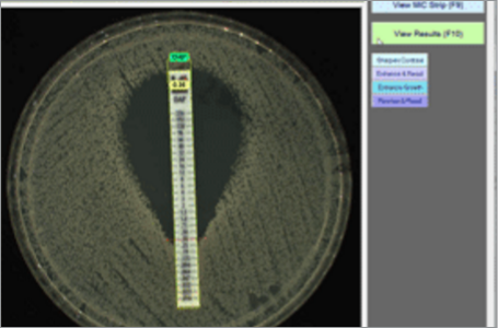 MIC Test Strip esempio 2