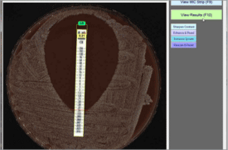MIC Test Strip esempio 4