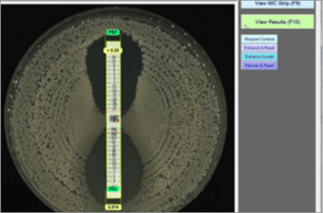 MIC Test Strip esempio 3