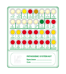 Direct microbial identification