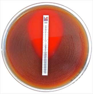 MTS™ (MIC Test Strip)