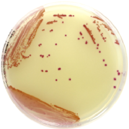 Chromatic MRSA