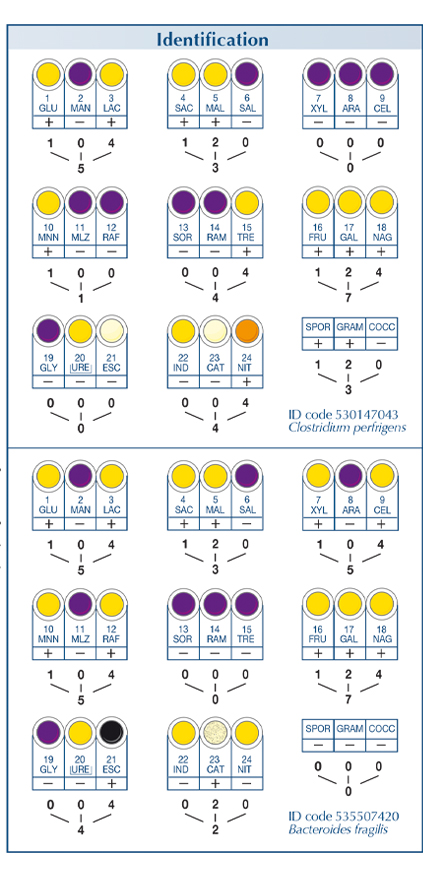 Anaerobe system