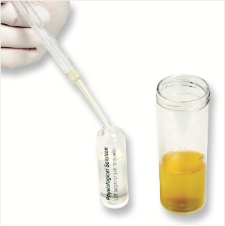 Urine analysis