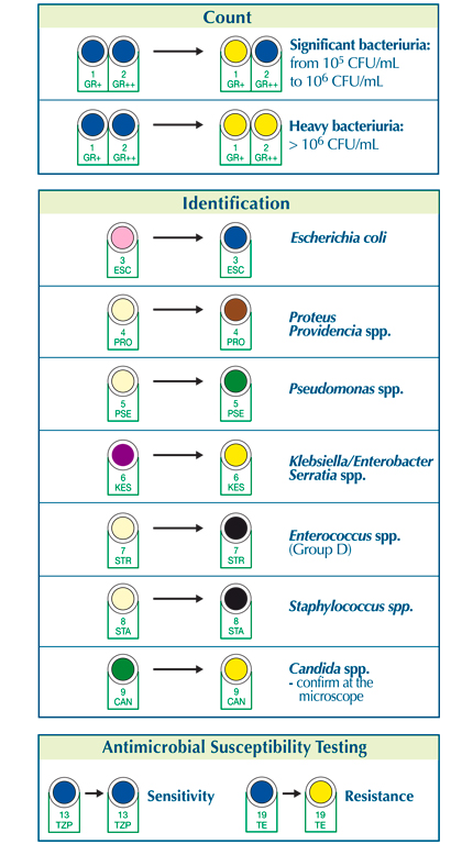 Urine System Plus